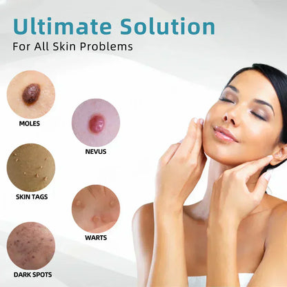 ✨EETTSY™ All-in-One CO₂ Laser Eraser Pen | Removes Moles, Warts, Skin Flaws & Pigmentation