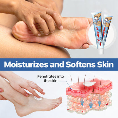 Diabetes Treatment Cream -👨‍⚕️American Academy of Dermatology (AAD) Approved✅