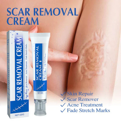 Eettsy®𝐒𝐜𝐚𝐫 𝐑𝐞𝐩𝐚𝐢𝐫 𝐂𝐫𝐞𝐚𝐦 𝐟𝐨𝐫 𝐌𝐞𝐧 𝐚𝐧𝐝 𝐖𝐨𝐦𝐞𝐧, 𝐟𝐚𝐝𝐞 𝐬𝐜𝐚𝐫𝐬 𝐚𝐧𝐝 𝐭𝐢𝐠𝐡𝐭𝐞𝐧 𝐬𝐤𝐢𝐧 𝐢𝐧 𝐨𝐧𝐞 𝐬𝐭𝐞𝐩