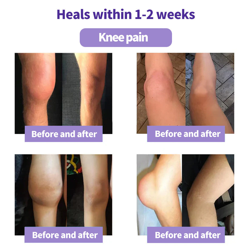 Eettsy™ Turmeric & Emu Oil Arthritis Soothing Pain Relief Massage Gel 👨‍⚕️Australian Osteopathic Association （AOA）Approved