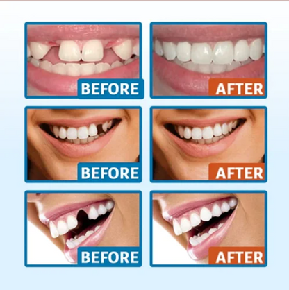 Temporary Tooth Sculptor Repair Kit