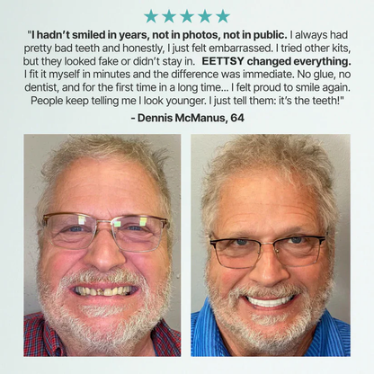 🦷Ends Today: 70% OFF!  Custom-Fit Full Functional DenturesMake you more confident