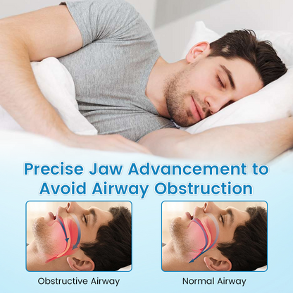 🌙 SILENT NIGHTS, STRONG TEETH! 🦷 Anti-Snoring Guard 🔵✨