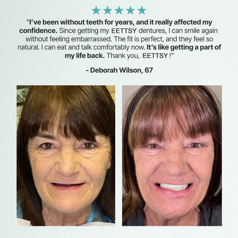 🦷Ends Today: 70% OFF!  Custom-Fit Full Functional DenturesMake you more confident