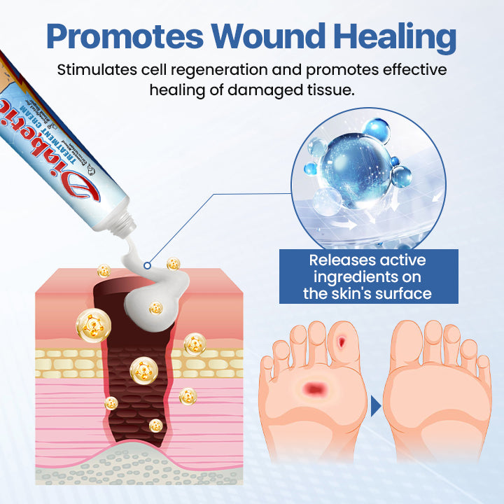Diabetes Treatment Cream -👨‍⚕️American Academy of Dermatology (AAD) Approved✅