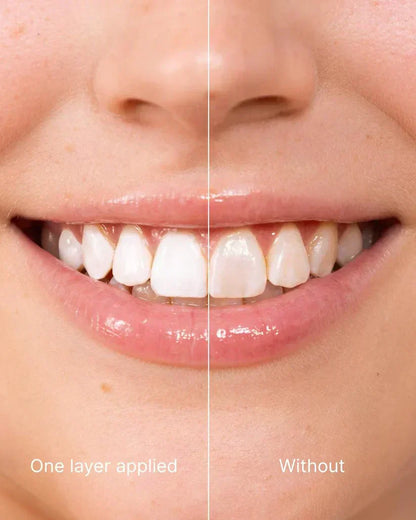 EETTSY™ Tooth Whitening - Instant Clean Smile
