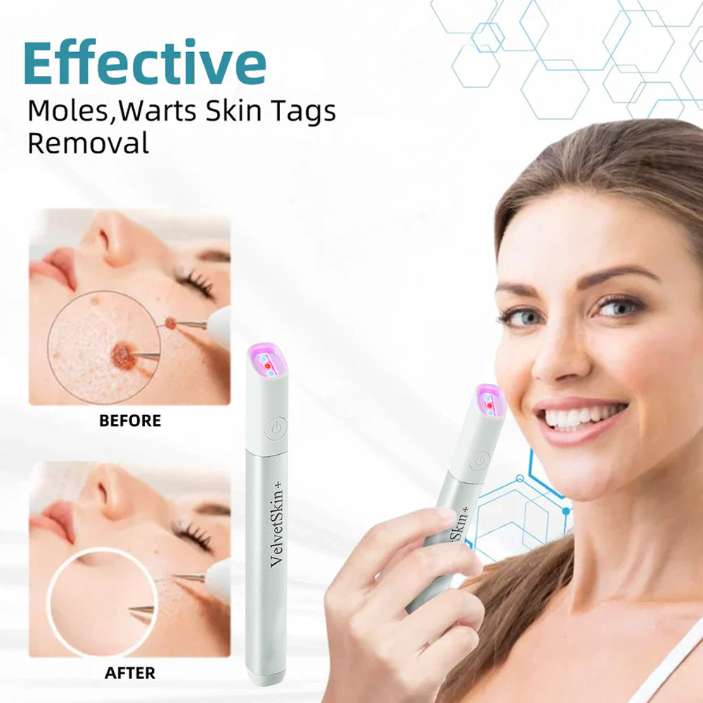 ✨EETTSY™ All-in-One CO₂ Laser Eraser Pen | Removes Moles, Warts, Skin Flaws & Pigmentation