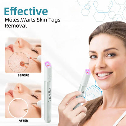 ✨EETTSY™ All-in-One CO₂ Laser Eraser Pen | Removes Moles, Warts, Skin Flaws & Pigmentation