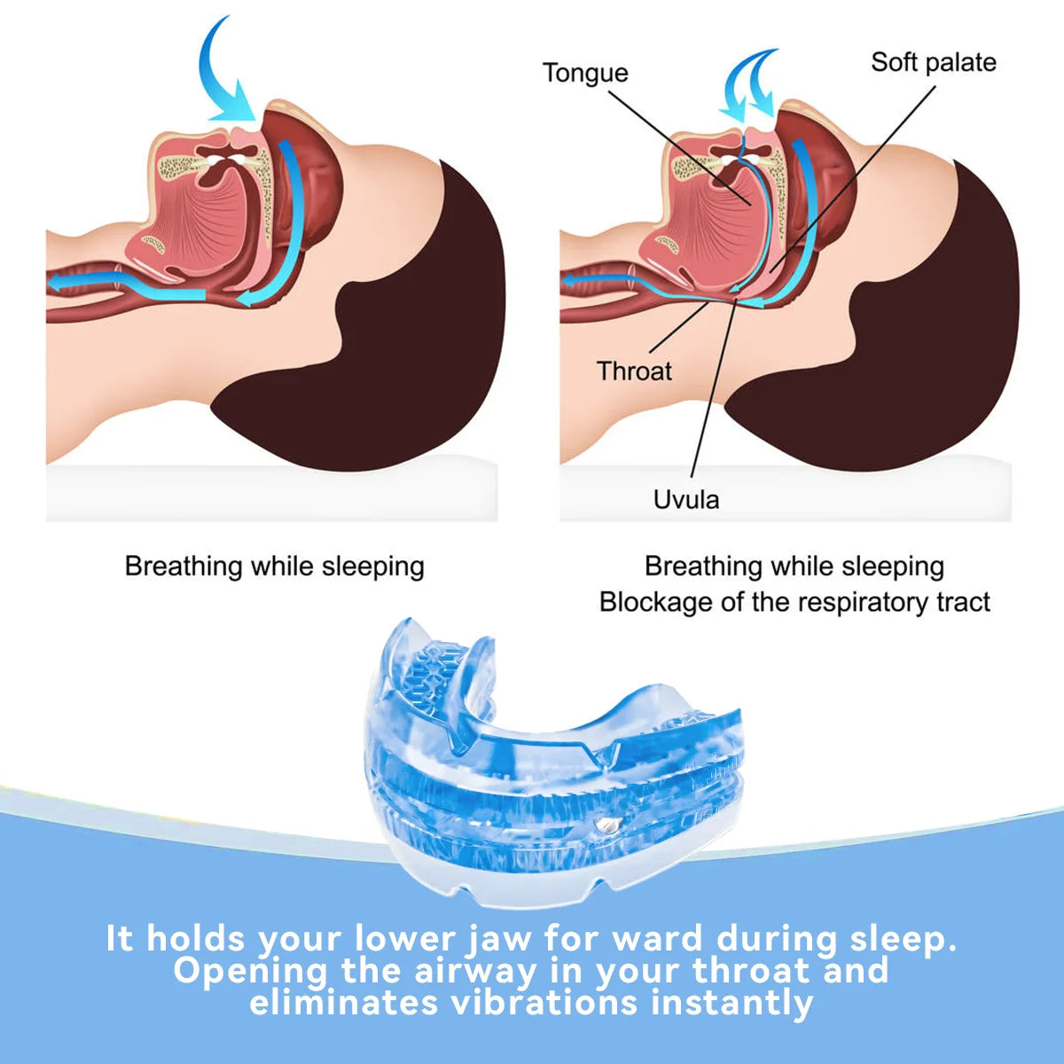 Niki | Adjustable Anti-Snoring Mouthguard Made of BPA-Free Material