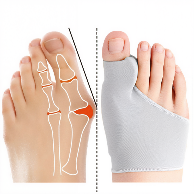 Niki | Gel Bunion Straightener for Toe Pain Relief