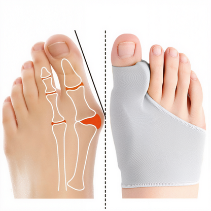 Niki | Gel Bunion Straightener for Toe Pain Relief