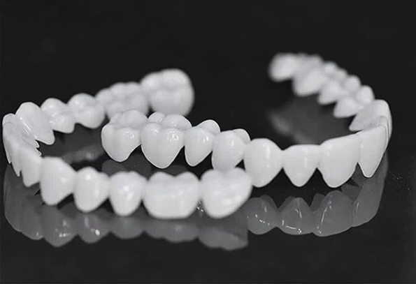Niki | DentAlign Dental Veneers – Natural Fit and Comfort