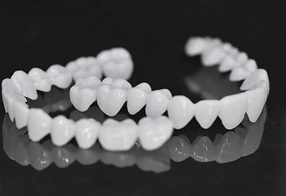 Niki | DentAlign Dental Veneers – Natural Fit and Comfort