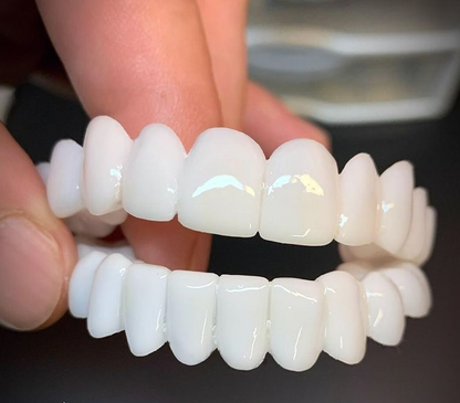 Niki | DentAlign Dental Veneers – Natural Fit and Comfort