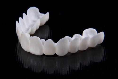 Niki | DentAlign Dental Veneers – Natural Fit and Comfort