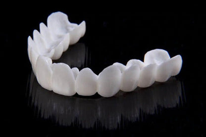 Niki | DentAlign Dental Veneers – Natural Fit and Comfort