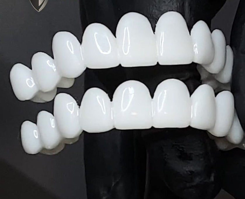Niki | DentAlign Dental Veneers – Natural Fit and Comfort
