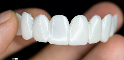Niki | DentAlign Dental Veneers – Natural Fit and Comfort
