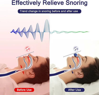 Niki | Micro CPAP Sleep Apnea Machine for Travel & Anti-Snoring