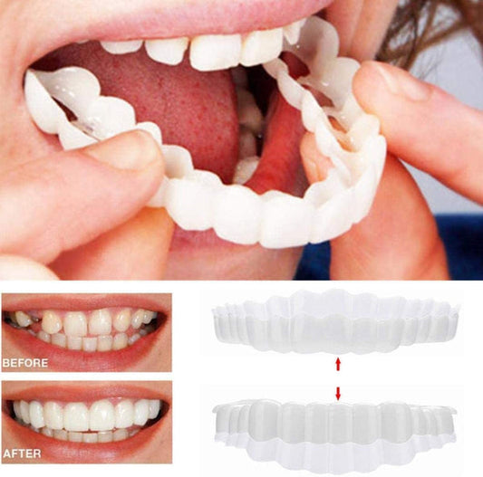 Niki | On Smile Veneers (Upper and Lower Jaw included)