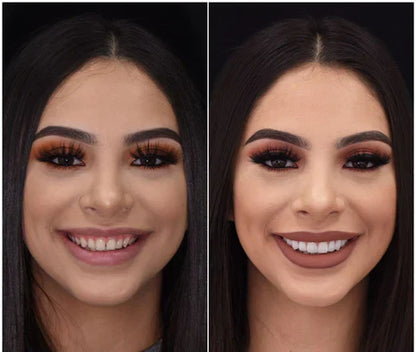 NovaBright Snap On Veneers For Upper And Lower Teeth Instant Natural Smile